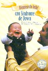 Bienvenido Bebe con Sindrome de Down