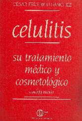 Celulitis