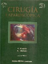 Cirugia Laparoscopica