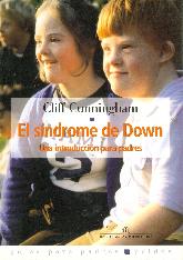 El Sindrome de Down 