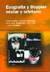 Ecografia y Doppler ocular y orbitario