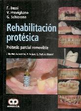 Rehabilitacin protsica