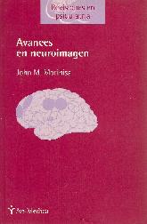 Avances en neuroimagen