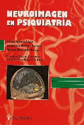 Neuroimagen en psiquiatra