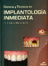 Ciencia y Tecnica en Implantologia Inmediata - 2 Tomos