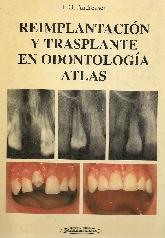 Reimplantacion y transplante en odontologia