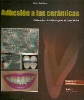 Adhesion a las ceramicas