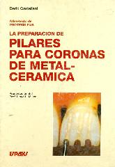 La preparacion de pilares para coronas de metalceramica atlas texto de protesis fija