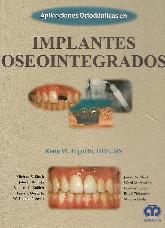 Aplicaciones Ortodnticas en Implantes Oseosintegrados