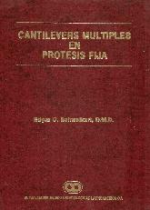 Cantilevers mltiples en prtesis fija