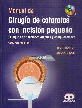 Manual de Ciruga de cataratas con Incisin Pequea