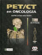 PET / CT en Oncologa