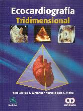 Ecocardiografa Tridimensional