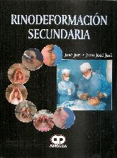 Rinodeformacin Secundaria