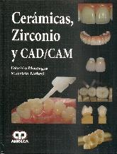 Cermicas, Zirconio y CAD/CAM