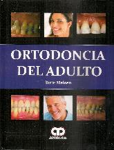 Ortodoncia del Adulto