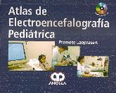 Atlas de Electroencefalografa Peditrica