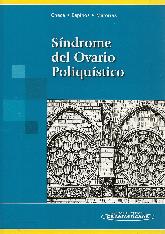 Sindrome del Ovario Poliquistico