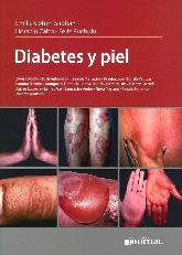 Diabetes y Piel