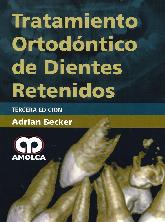 Tratamiento Ortodntico de Dientes Retenidos