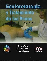 Escleroterapia y Tratamiento de las Venas