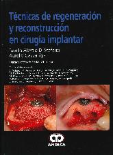 Tcnicas de Regeneracin y Reconstruccin en Ciruga Implantar