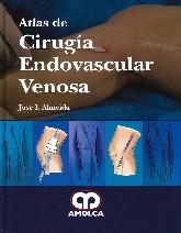 Atlas de Ciruga Endovascular Venosa