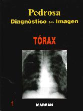 Pedrosa Diagnstico por Imagen Trax 1