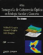 Atlas Tomografa de Coherencia ptica en Aptologa Macular y Glaucoma