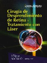 Ciruga de Desprendimiento de Retina y Tratamiento con Lser