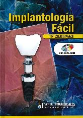 Implantologa Fcil