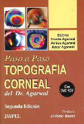 Topografa Corneal del Dr. Agarwal