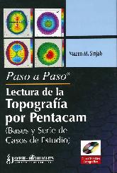 Lectura de la Topografa por Pentacam