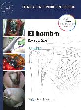 El Hombro 