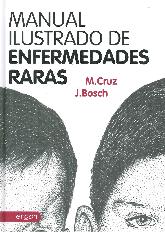 Manual ilustrado de enfermedades raras