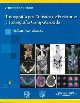 Tomografa por Emisin de Positrones y Tomografa Computarizada