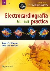 Electrocardiografa Prctica Marriott