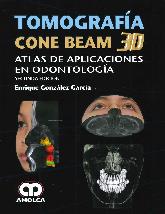 Tomografa Cone Beam 3D