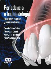 Periodoncia e Implantologa