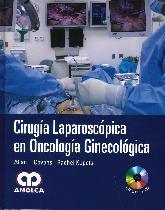 Ciruga Laparoscopica en Oncologa Ginecolgica