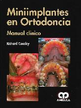Miniimplantes en Ortodoncia