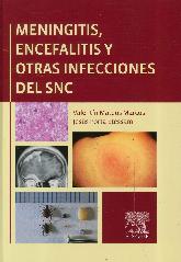 Meningitis, Encefalitis y Otras Infecciones del SNC