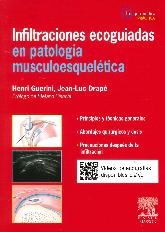 Infiltraciones ecoguiadas en patología musculoesqueletica