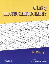 Atlas of Electrocardiography