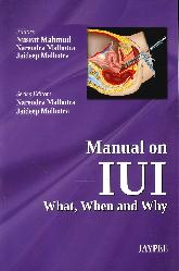 Manual on IUI What, When and Why