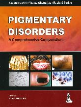 Pigmentary Disorders