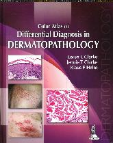 Color Atlas of Differential Diagnosis in Dermatopathology