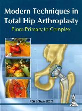 Modern Techniques in Total Hip Arthroplasty