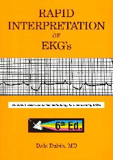 Rapid interpretation of EKG's