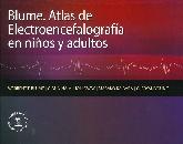 Atlas de electroencefalografa en nios y adultos